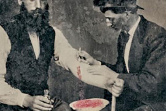 血液放血的潜在益处——是的，就是放血