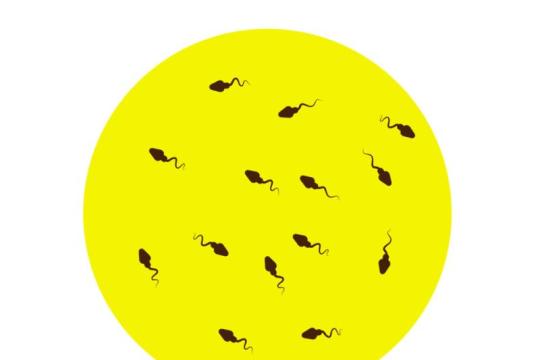 一项令人担忧的新研究探讨手机使用与精子数量的关系