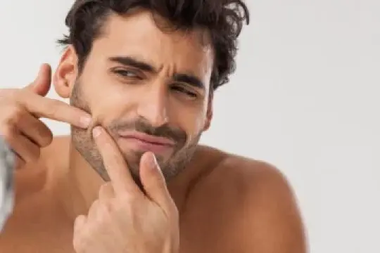 成年痤疮并非终身困扰——教你如何有效应对