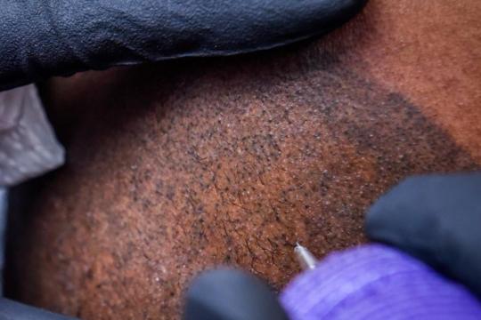 越来越多男性选择纹身艺术家来解决脱发问题的原因