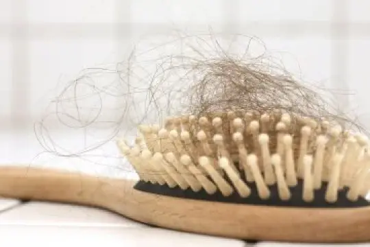 遗传因素并非总是脱发的唯一原因