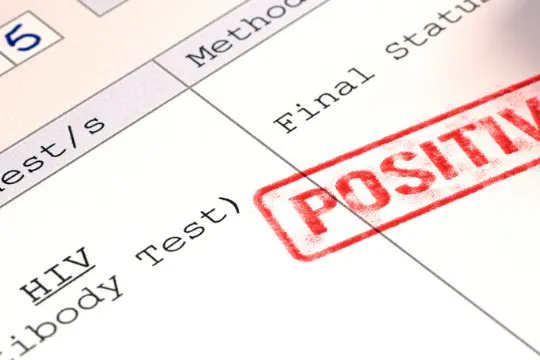 与男性发生性关系时，HIV的真实风险有哪些？