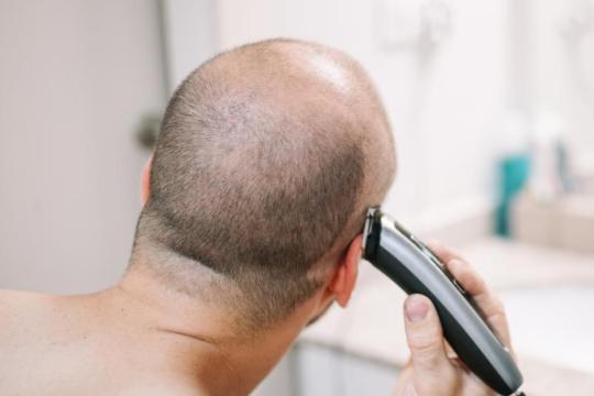 你适合剃光头的“光头强”造型吗？教你如何判断