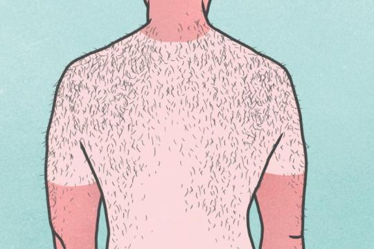 全面护肤指南：如何护理晒伤皮肤