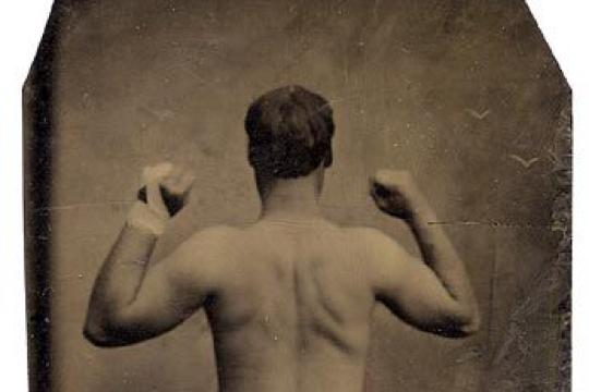 战胜背部痤疮：男性背部护肤全攻略