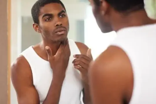 专家揭秘修复痤疮疤痕的最佳方法